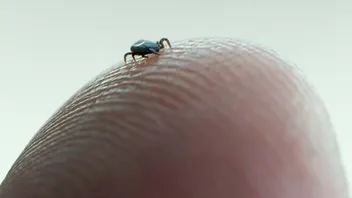 Bilder på fästningar ska hjälpa myndigheten att analysera dem Foto: Fredrik Sandberg/TT