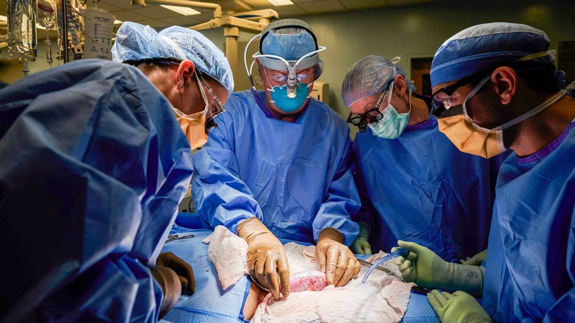 Grisnjuren transplanterades utanför människokroppen för att läkarna skulle kunna följa tillvänjningen bättre. Foto: Joe Carrotta/NYU Langone Health/handout via AP/TT