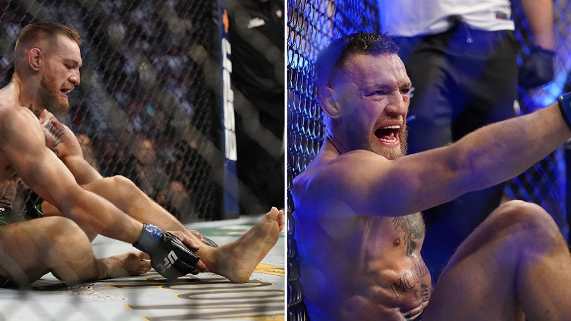 UFC: Här bryter MMA-stjärnan benet mitt under matchen