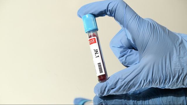 Enligt Folkhalsomyndigheten pågår smittspridningen av covid-19 på en relativt låg nivå. I Sverige är omikronundervarianten BA.2.86 fortsatt den dominerande virustypen och den vanligaste undergruppen är JN.1. Foto: MIKAEL FRITZON/TT