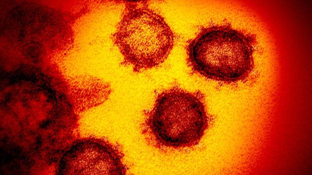 This undated electron microscope image made available by the U.S. National Institutes of Health in February 2020 shows the virus that causes COVID-19. Photo: NIAID-RML via AP/TT