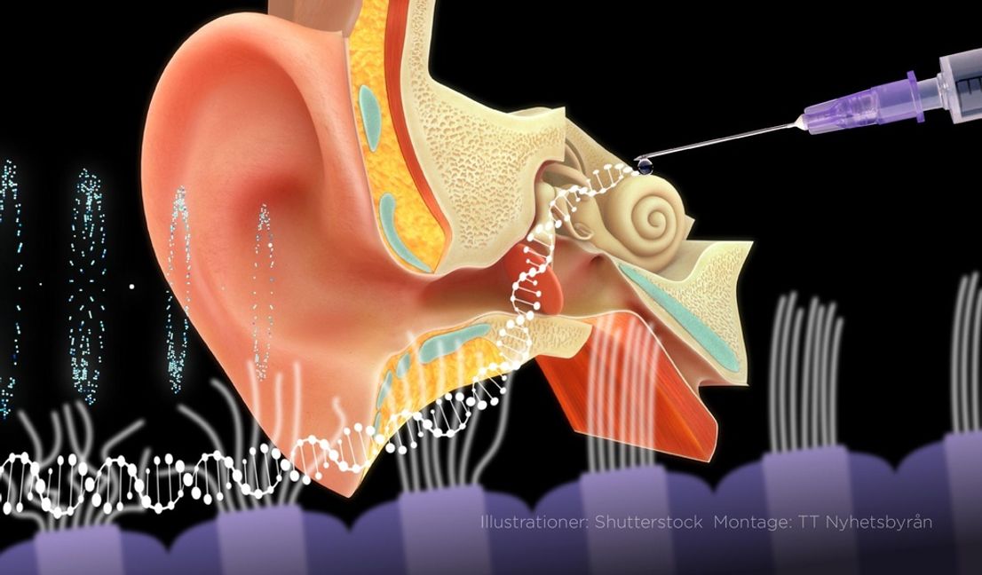 Personer som varit döva eller svårt hörselnedsatta sedan födseln har fått hörseln tillbaka genom injektioner av ett syntetiskt virus på hörselsnäckan. Foto: Anders Humlebo/TT