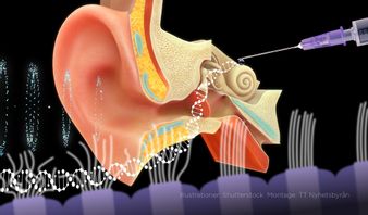 Personer som varit döva eller svårt hörselnedsatta sedan födseln har fått hörseln tillbaka genom injektioner av ett syntetiskt virus på hörselsnäckan. Foto: Anders Humlebo/TT