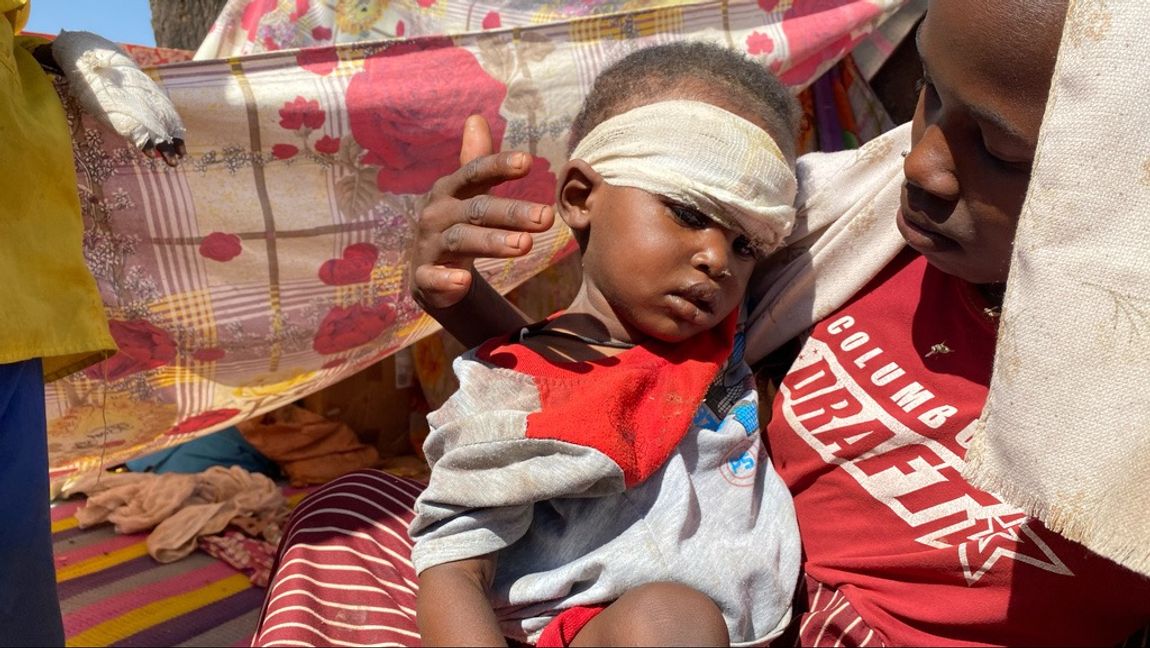 Inte ens barnen skonas. Men för väst finns en påtaglig skillnad i reaktionen. Foto: Mohammed Abaker/AP/TT