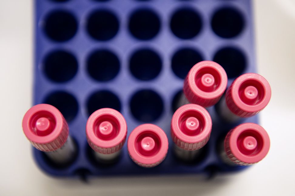 Avvikelserna bedöms kunna få negativ påverkan och konsekvenser för människors hälsa. Arkivbild. Jessica Gow/TT