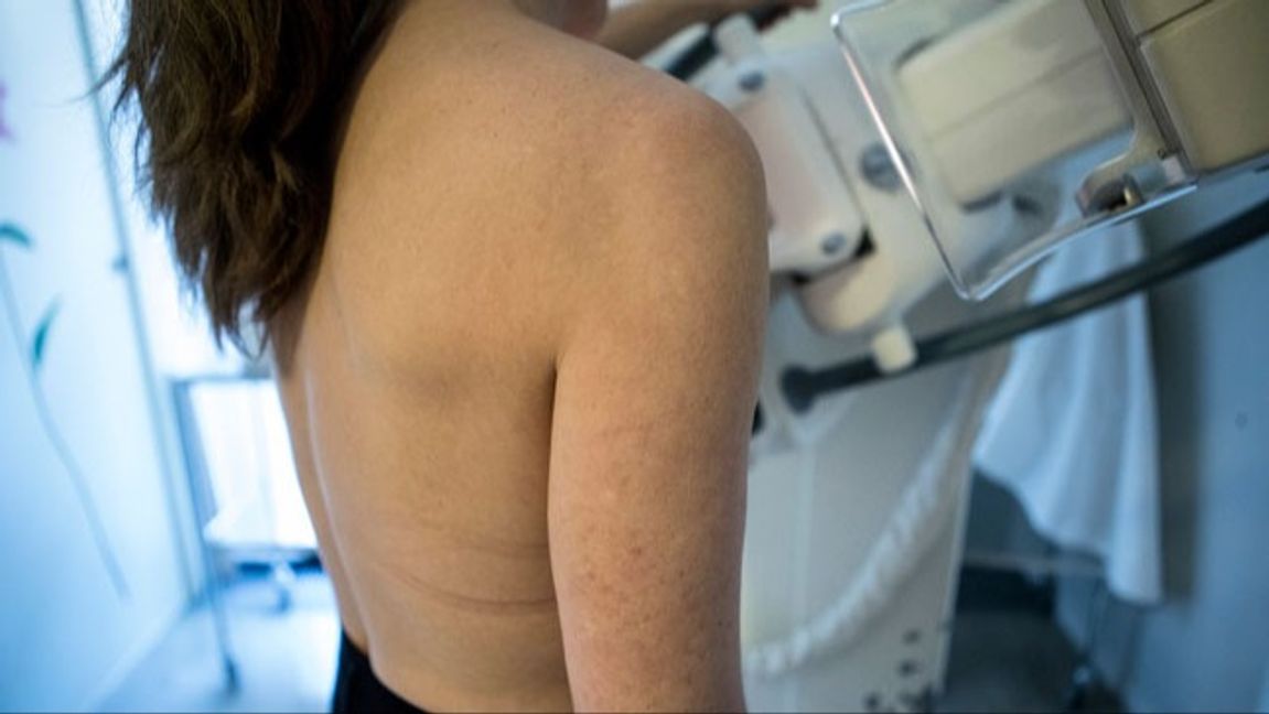 Ett digitalt bildbehandlingssystem för bröstcancerscreening har gett felaktiga svar till flera kvinnor. Region Stockholm har anmält programvaran till Läkemedelsverket och IVO. Foto: Christine Olsson/TT.