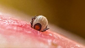 Fästing festar på ett ben. Arkivbild. Jonas Ekströmer/TT