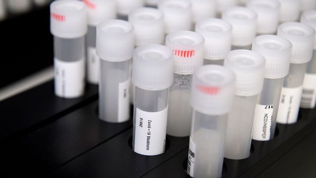 PCR-tester. Foto: Jessica Gow/TT