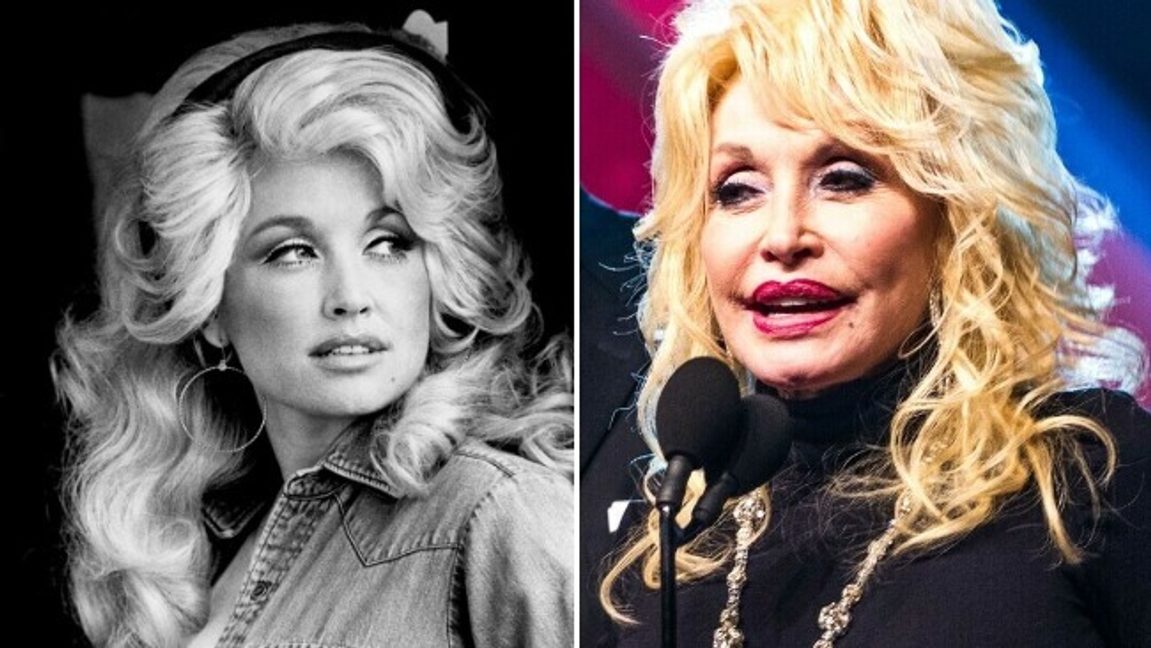 Dolly Parton år 1977 och 2016. Bild: Public Domain/Movieguide®/CC BY-SA 2.0