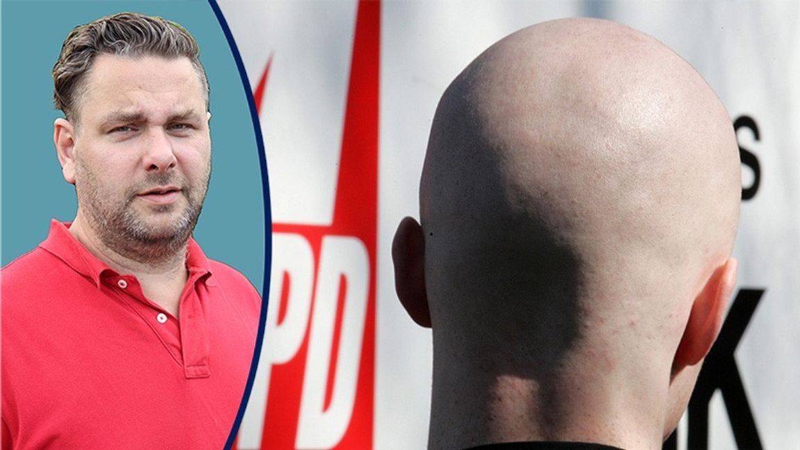 Antisemitismen har bytt utseende och domineras inte längre av skinheads. Foto: Joerg Sarbach/AP/TT