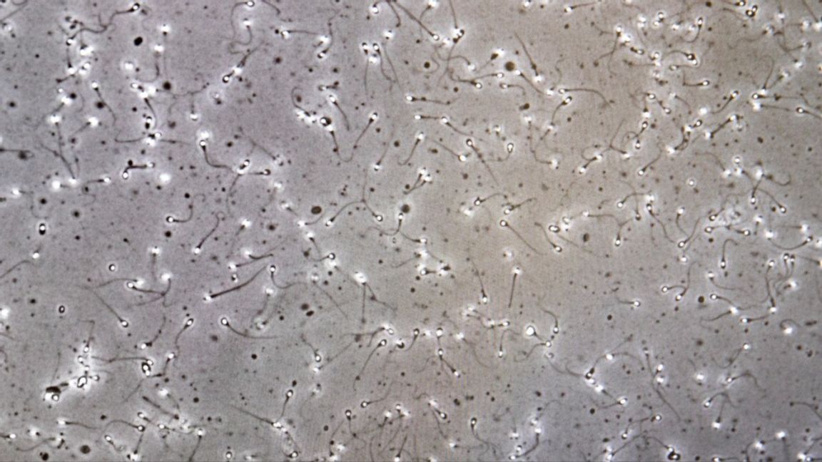 IVF på nationell nivå? Foto: Gorm Kallestad / TT