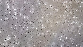 IVF på nationell nivå? Foto: Gorm Kallestad / TT