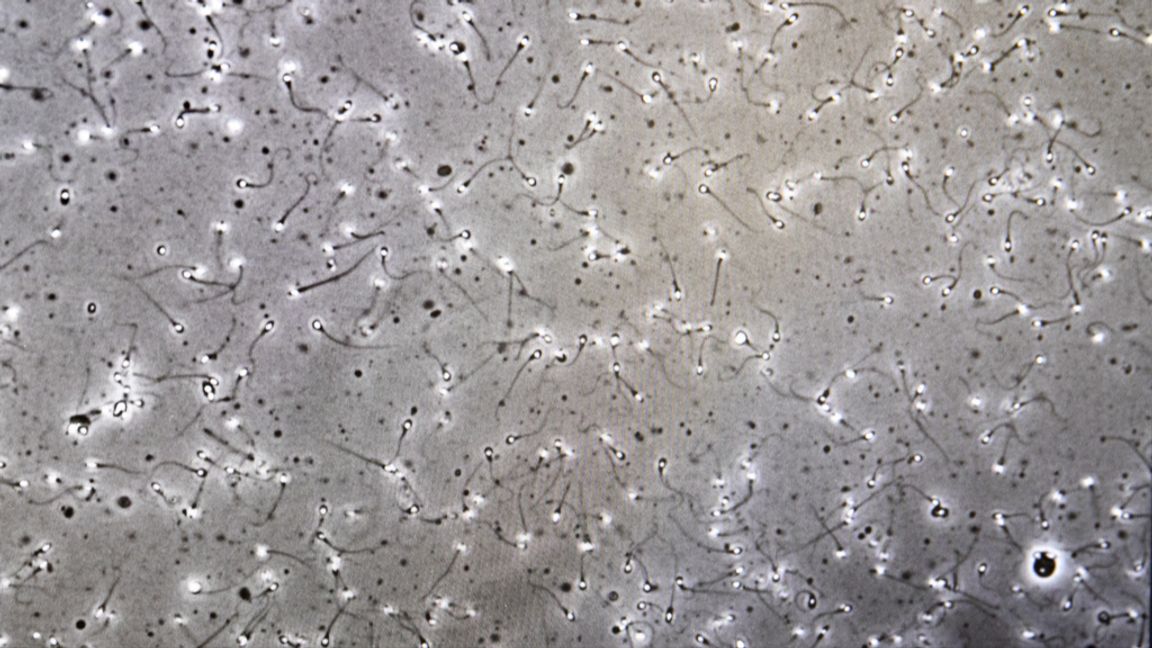 En anonym finländsk man har blivit pappa till över 30 barn i Sverige – via spermadonation. Arkivbild. Gorm Kallestad/NTB/TT