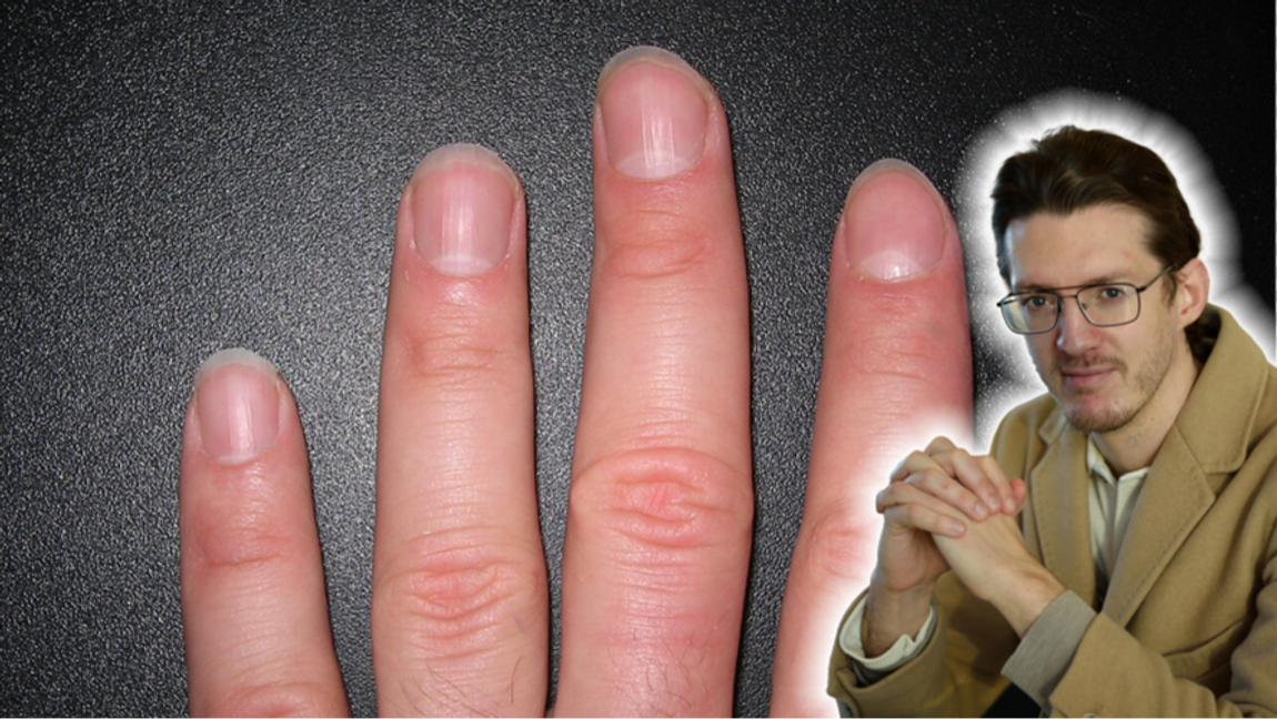 Det gäller för unga män att lägga band på nagelbanden. Foto: Kommissar, Public Domain, via Wikimedia Commons