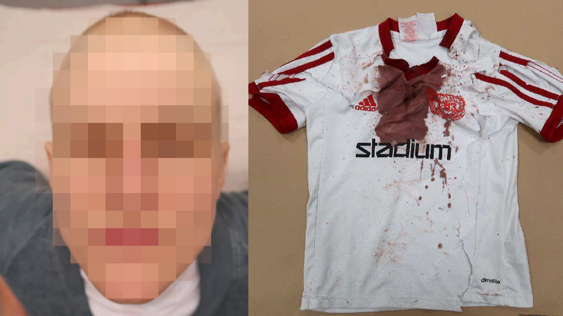 Kvinnan kunde gripas samma kväll. Till höger bild på pojkens blodiga T-shirt. Foto: Polisen