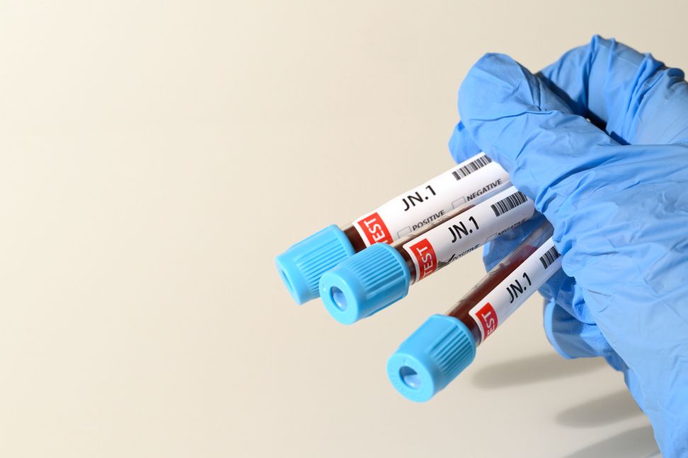 Transportstyrelsen föreslår att slopa peth-tester. Arkivbild. Foto: Mikael Fritzon/TT